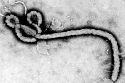 Nhận biết và phòng ngừa đại dịch chết người Ebola